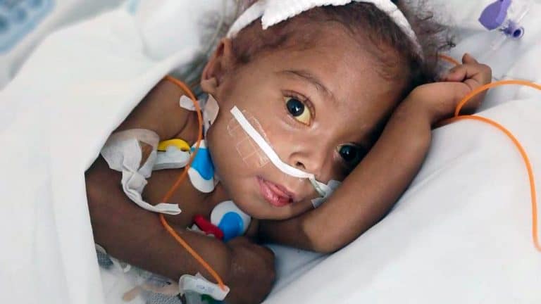 Actualización sobre el caso de Amanda: la niña lucha y mejora de salud